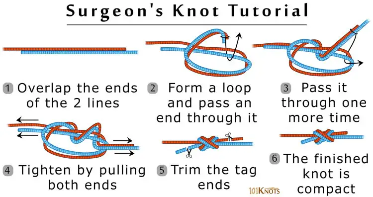 How to Tie a Surgeon’s Knot